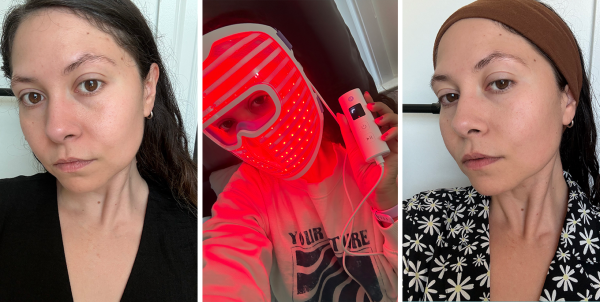 best red light therapy mask: irestore illumina mask