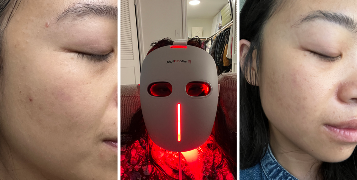 best red light therapy mask: mitoglow