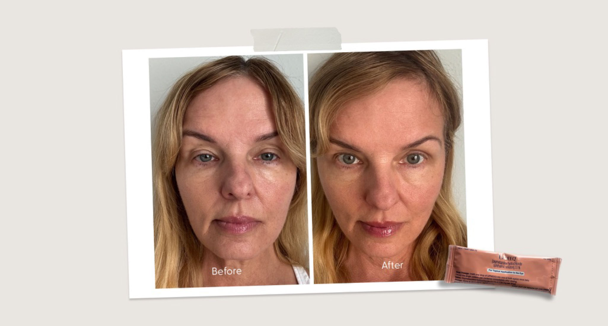 upneeq-eye-drops-review