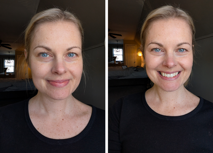 typology a43 skin tightening concentrate review: candace before and after