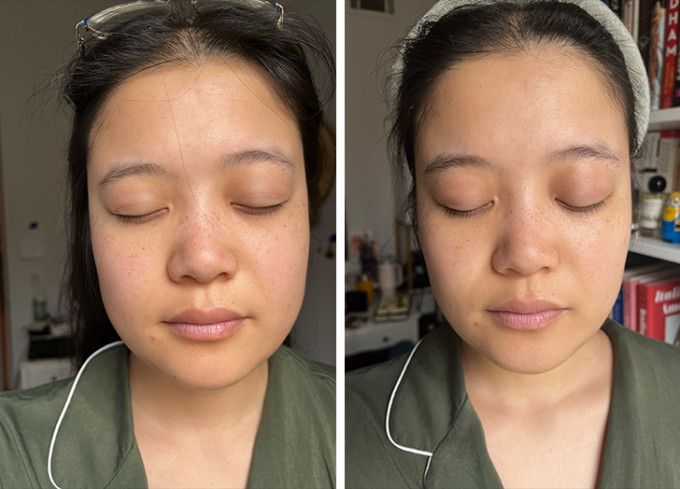 typology a43 skin tightening concentrate review