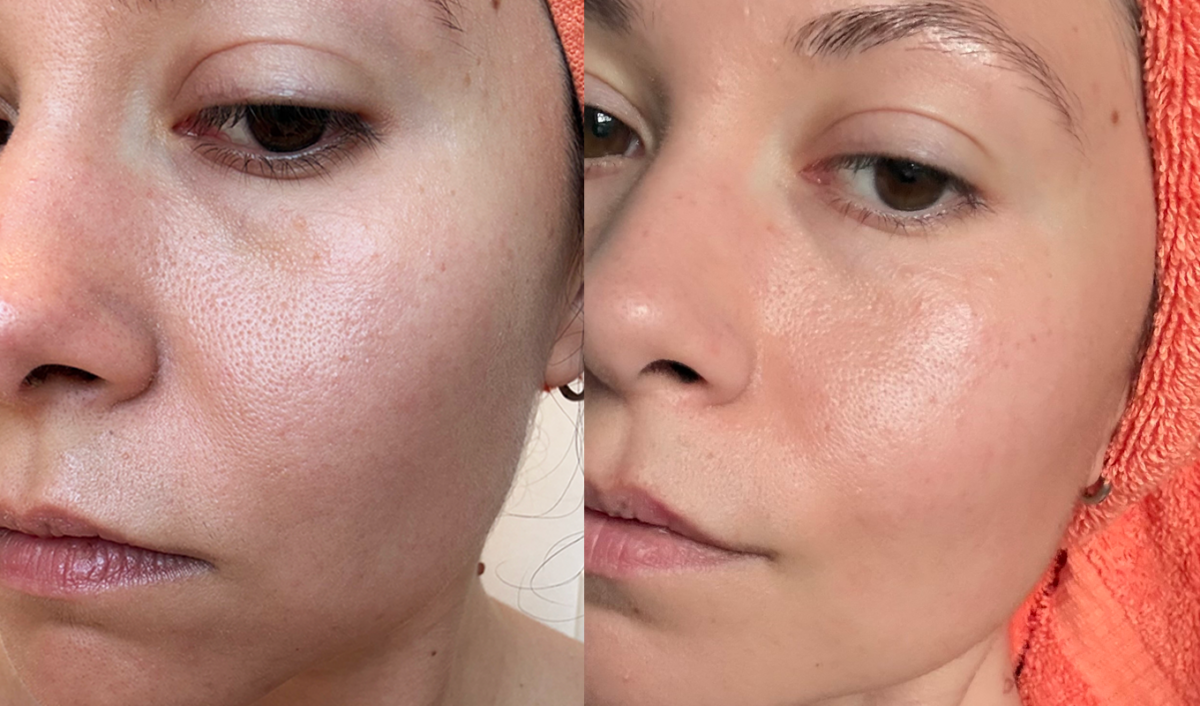 zoskinhealth beforeafter 1200x706