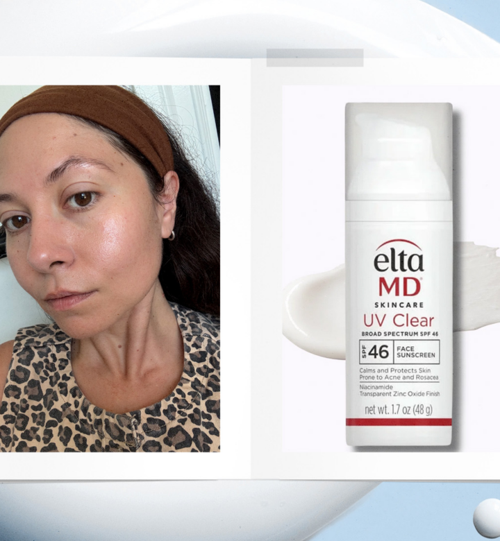 EltaMD UV Clear Review 2026