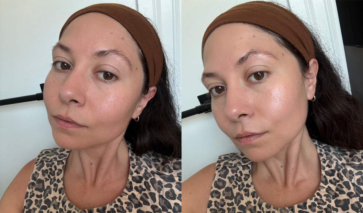 EltaMD UV Clear Review: Before and after original photos by Stephanie Maida